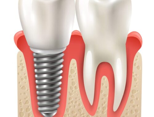 КЛИНИКА СПАС в Москве: Профессиональная стоматология с заботой о вашем комфорте КЛИНИКА СПАС в Москве: Профессиональная стоматология с заботой о вашем комфорте